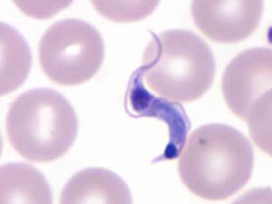 American Trypanosomiasis (Chagas)