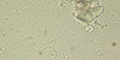 Entamoeba coli