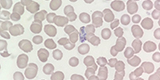 Plasmodium malarie