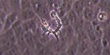 Balamuthia trophozoite on Vero E6 cells