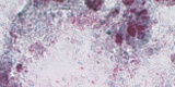 Microsporidia4