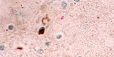 Microsporidia1
