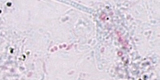 Microsporidia3