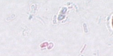 Microsporidia6