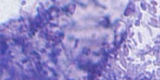 Microsporidia8