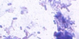 Microsporidia9
