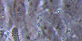 Microsporidia10